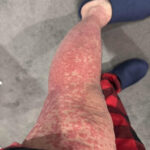 💅 Si des lignes apparaissent sur vos ongles après 40 ans, cela pourrait être un signe d’avertissement