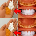Cuir chevelu qui démange ? Voici les causes les plus fréquentes des irritations persistantes, pellicules, rougeurs et inconfort